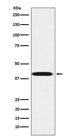Anti-LHX3 Rabbit Monoclonal Antibody Boster Bio