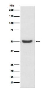 Anti-PDIA6/Erp5 Rabbit Monoclonal Antibody Boster Bio