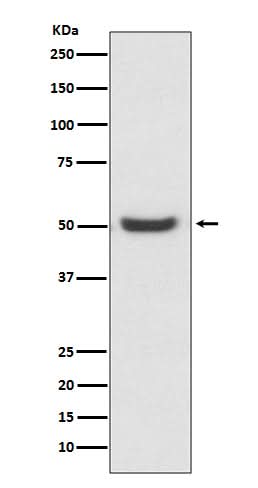 Anti-PDIA6/Erp5 Rabbit Monoclonal Antibody Boster Bio