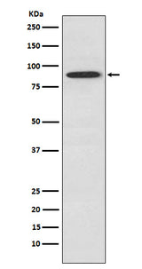 Anti-SAE2 / UBA2 Monoclonal Antibody Boster Bio