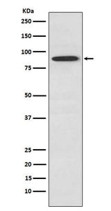 Anti-SAE2 / UBA2 Monoclonal Antibody Boster Bio
