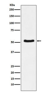 Anti-DDX6 Rabbit Monoclonal Antibody Boster Bio