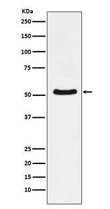 Anti-DDX6 Rabbit Monoclonal Antibody Boster Bio