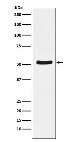 Anti-DDX6 Rabbit Monoclonal Antibody Boster Bio
