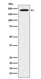 Anti-DOCK2 Rabbit Monoclonal Antibody Boster Bio