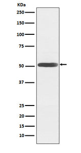 Anti-Inhibin beta B Rabbit Monoclonal Antibody Boster Bio