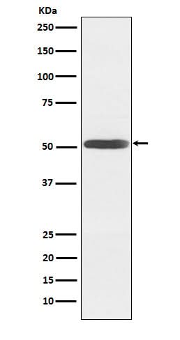 Anti-Inhibin beta B Rabbit Monoclonal Antibody Boster Bio