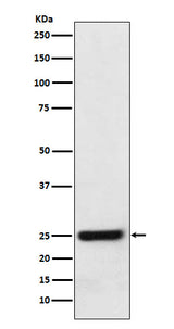 Anti-ERAB Monoclonal Antibody Boster Bio