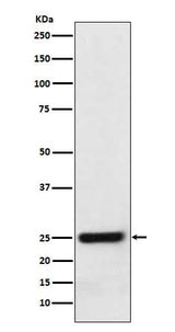 Anti-ERAB Monoclonal Antibody Boster Bio