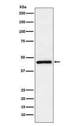 Anti-TMEFF2 Rabbit Monoclonal Antibody Boster Bio
