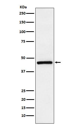 Anti-TMEFF2 Rabbit Monoclonal Antibody Boster Bio