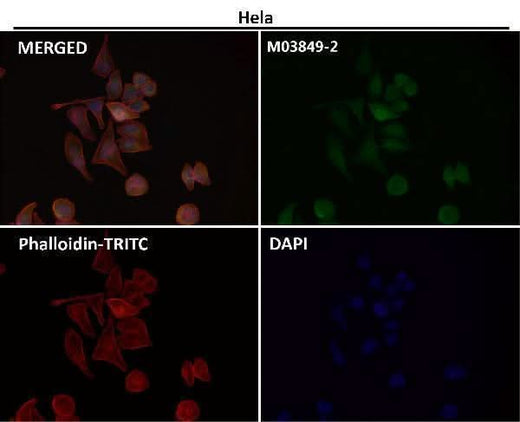 Anti-Destrin Rabbit Monoclonal Antibody Boster Bio