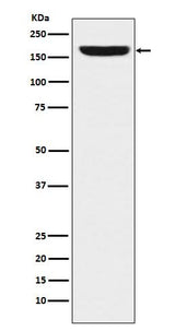 Anti-REST / NRSF Rabbit Monoclonal Antibody Boster Bio