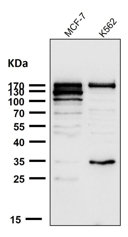 Anti-ATAD2 Rabbit Monoclonal Antibody Boster Bio