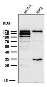 Anti-ATAD2 Rabbit Monoclonal Antibody Boster Bio