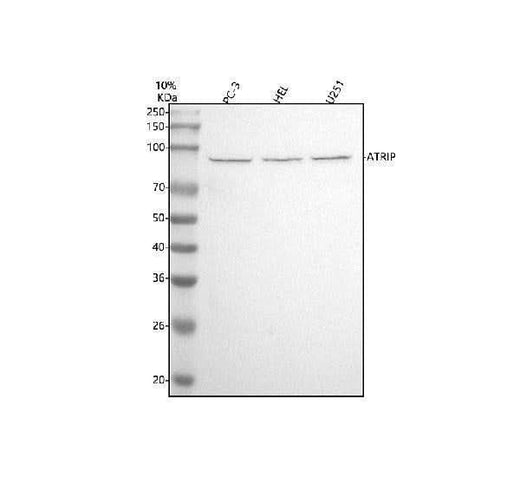 Anti-ATRIP Rabbit Monoclonal Antibody Boster Bio