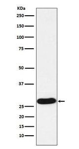 Anti-PR3 Rabbit Monoclonal Antibody Boster Bio