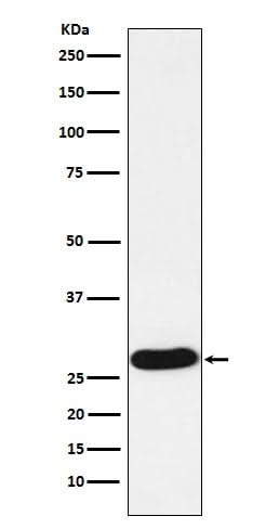 Anti-PR3 Rabbit Monoclonal Antibody Boster Bio