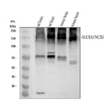 Anti-NCX1 Rabbit Monoclonal Antibody Boster Bio