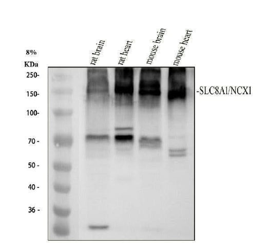 Anti-NCX1 Rabbit Monoclonal Antibody Boster Bio