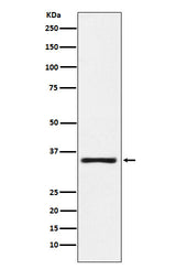 Anti-KLK2 Rabbit Monoclonal Antibody Boster Bio