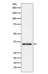 Anti-KLK2 Rabbit Monoclonal Antibody Boster Bio