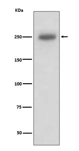 Anti-Laminin beta 1 LAMB1 Rabbit Monoclonal Antibody Boster Bio