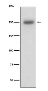 Anti-Laminin beta 1 LAMB1 Rabbit Monoclonal Antibody Boster Bio
