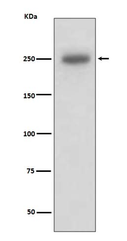 Anti-Laminin beta 1 LAMB1 Rabbit Monoclonal Antibody Boster Bio