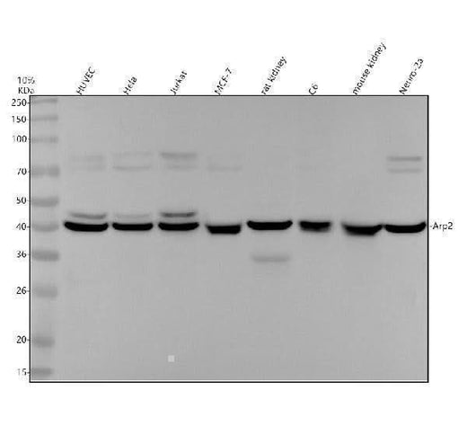 Anti-Arp2 Rabbit Monoclonal Antibody Boster Bio