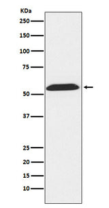 Anti-TXNRD2 Rabbit Monoclonal Antibody Boster Bio
