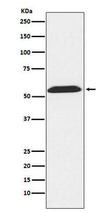 Anti-TXNRD2 Rabbit Monoclonal Antibody Boster Bio