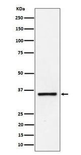 Anti-Kallikrein 8 Rabbit Monoclonal Antibody Boster Bio