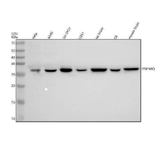 Anti-14-3-3 Theta YWHAQ Rabbit Monoclonal Antibody Boster Bio