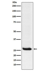 Anti-Hippocalcin Rabbit Monoclonal Antibody Boster Bio