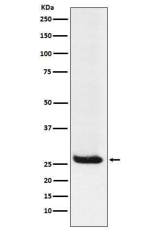 Anti-Hippocalcin Rabbit Monoclonal Antibody Boster Bio