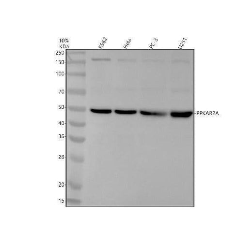 Anti-PKA R2 Rabbit Monoclonal Antibody Boster Bio