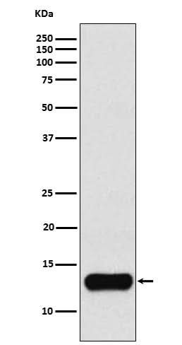 Anti-Cystatin A Rabbit Monoclonal Antibody Boster Bio