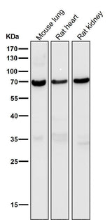 Anti-Perilipin A PLIN1 Rabbit Monoclonal Antibody Boster Bio