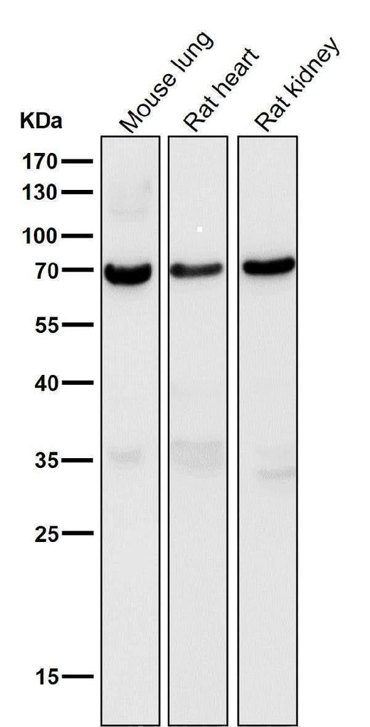 Anti-Perilipin A PLIN1 Rabbit Monoclonal Antibody Boster Bio