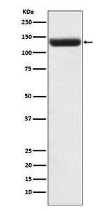 Anti-ZNF217 Rabbit Monoclonal Antibody Boster Bio