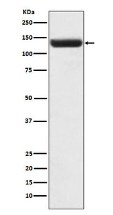 Anti-ZNF217 Rabbit Monoclonal Antibody Boster Bio