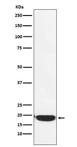 Anti-PERP Monoclonal Antibody Boster Bio