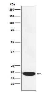 Anti-PERP Monoclonal Antibody Boster Bio
