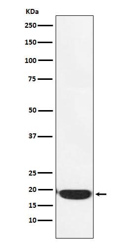 Anti-PERP Monoclonal Antibody Boster Bio