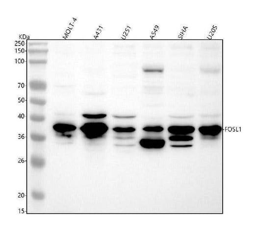 Anti-FRA1 Rabbit Monoclonal Antibody Boster Bio