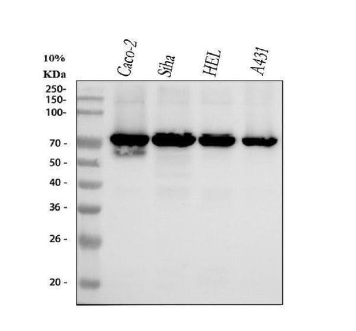 Anti-p60 CAF1 Rabbit Monoclonal Antibody Boster Bio
