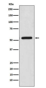 Anti-CaMKII Monoclonal Antibody Boster Bio