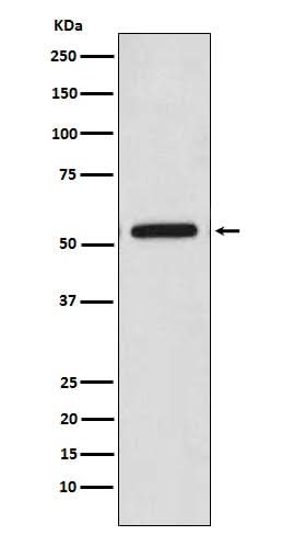 Anti-CaMKII Monoclonal Antibody Boster Bio