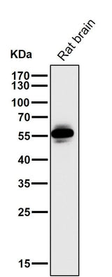 Anti-CaMKII CAMK2B Rabbit Monoclonal Antibody Boster Bio